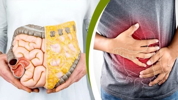 কমবয়সীদের মধ্যে বাড়ছে কোলন ক্যানসারের ঝুঁকি