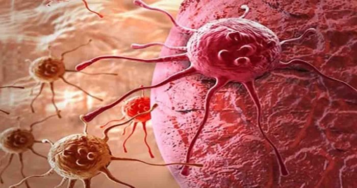 ক্যানসার বৃদ্ধির ভয়াবহ তথ্য দিল বিশ্ব স্বাস্থ্য সংস্থা