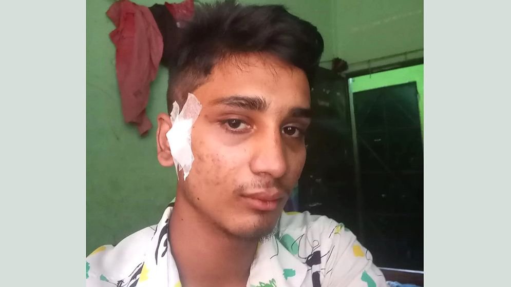 জুলাই বিপ্লবের তরুণ যোদ্ধা হৃদয়ের জানাজা ও দাফন সম্পন্ন হয়েছে