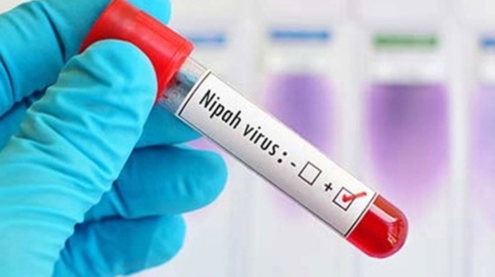নিপাহ ভাইরাস শনাক্ত ৩৫ জেলায়, হাসপাতালগুলোকে প্রস্তুত থাকার নির্দেশ