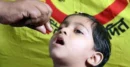 ভিটামিন ‘এ’ প্লাস ক্যাপসুল কারা পাবে, কারা পাবে না